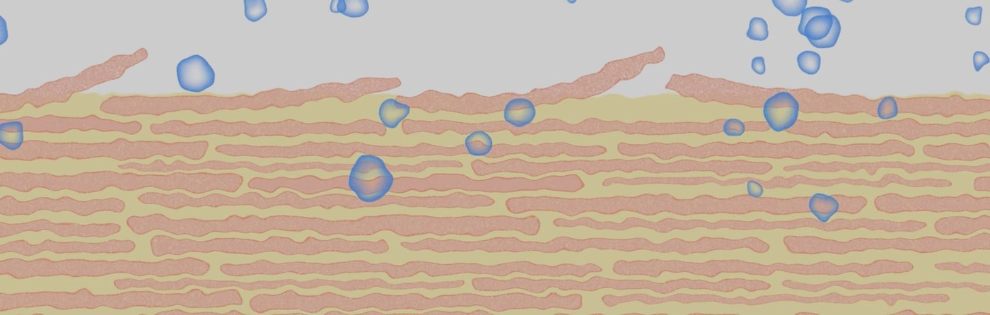 Superfine Merino Trials Explore Clothing Comfort for Eczema